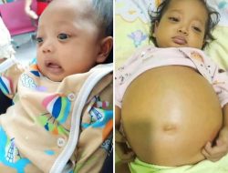 Balita 14 Bulan di Kabupaten Sorong Selatan Idap Penyakit Langka, Kesulitan Biaya Operasi